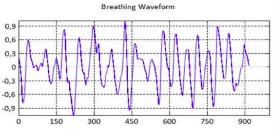 breathing-waveform.jpg